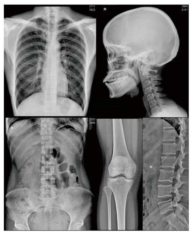 8x10 10x12 14x17 inch Medical dry X-ray Thermal film, blue PET polyester film for Agfa 5302 Fuji drypix 2000 3500 lite printers