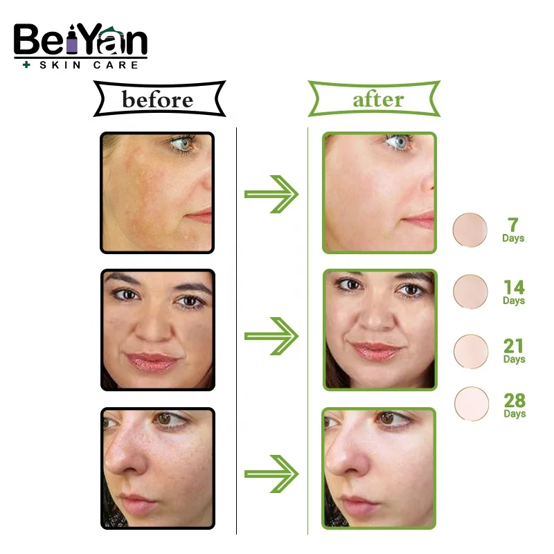 Private Label Vegan Vitamin C Moisturizer Cream 50ml with Green Tea Extracts for Dark Acne Scar Whitening Bleaching Anti-aging