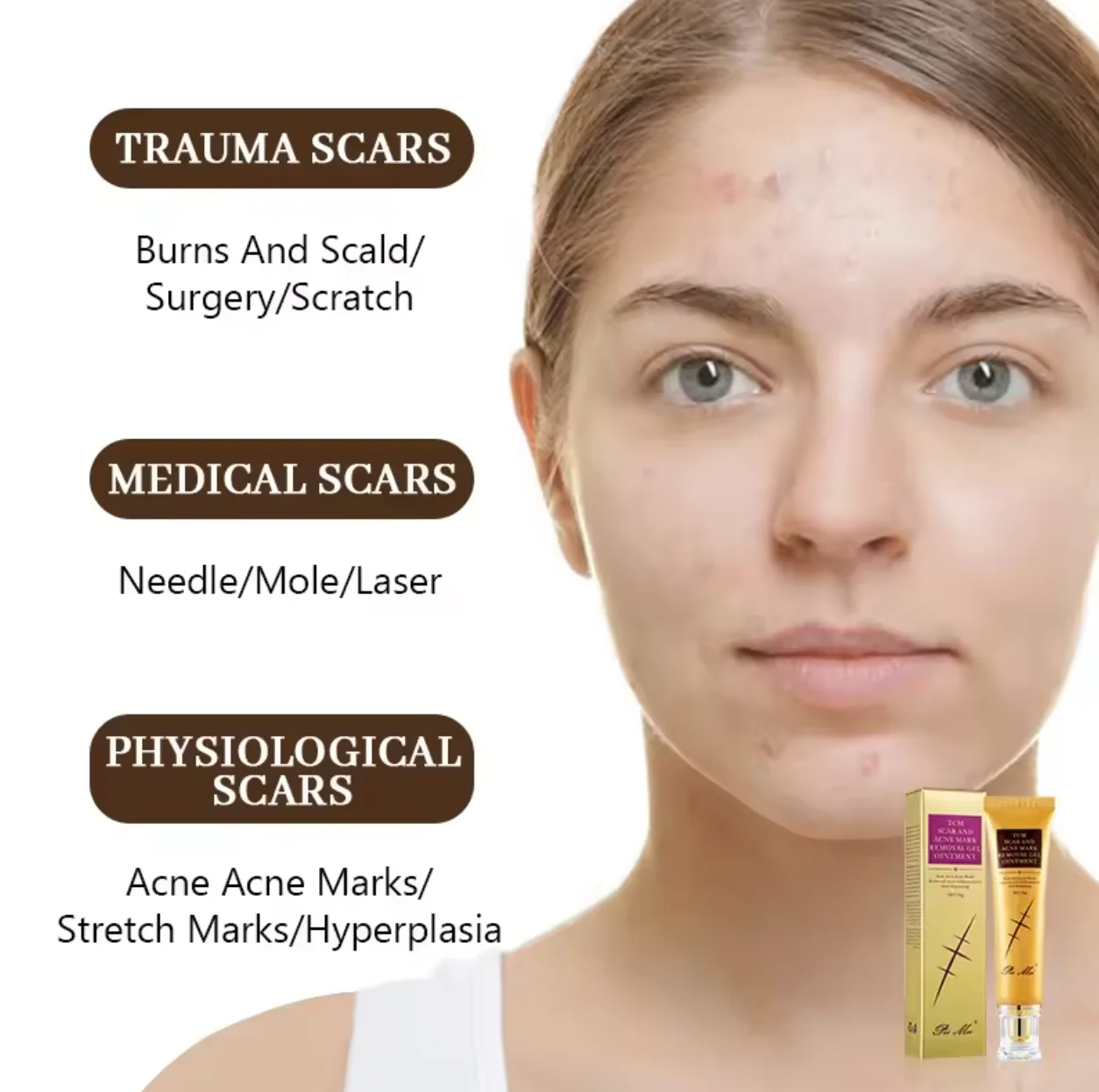 Wholesale custom face cream black spot acne whitening for face and legs old scar removing scar freckle face cream