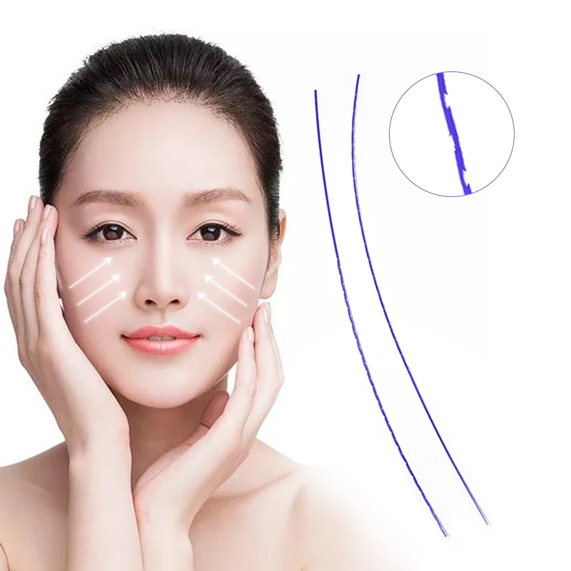 Plastic Surgery Medical 19G 100mm Whale Teeth Shape Molding Thread PDO with L Cannula