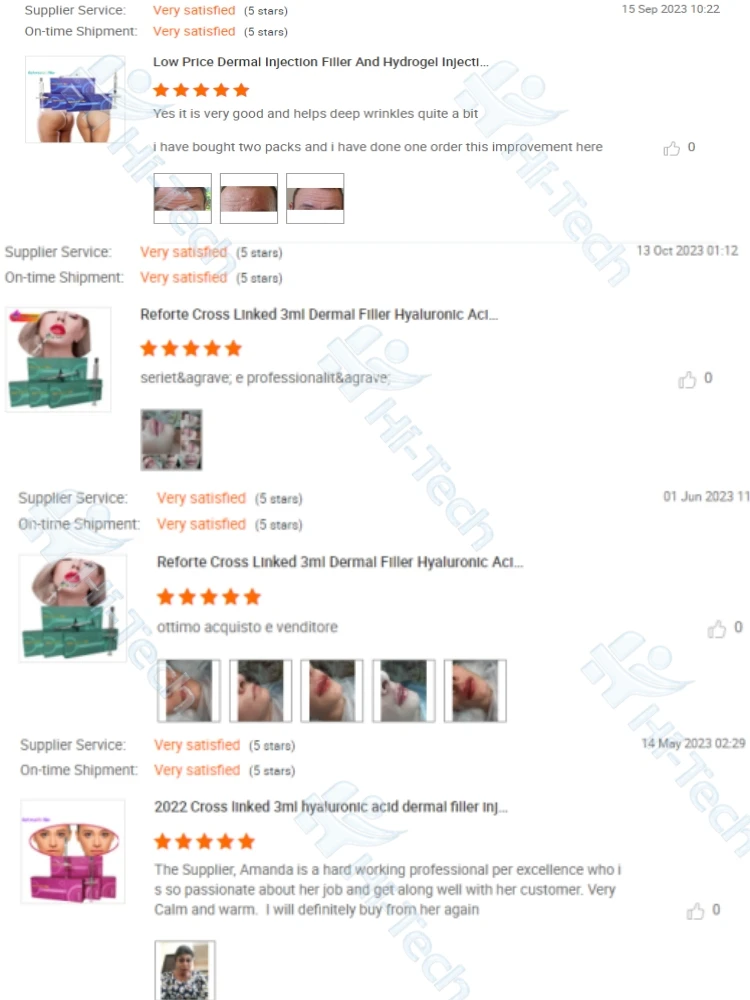 Korean Neuramis 1ml Ha Hyaluronic Acid Filler Dermal Filler Facial Filler For Forehead Nose Lips Chin Face