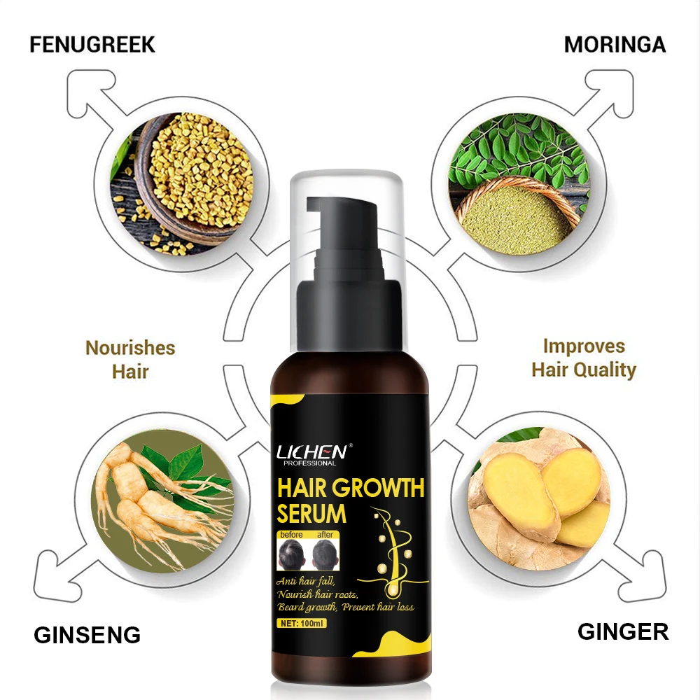 Лучший результат, сыворотки для быстрого роста волос ginger, Органическая натуральная формула, оптовая продажа для афроамериканских волос