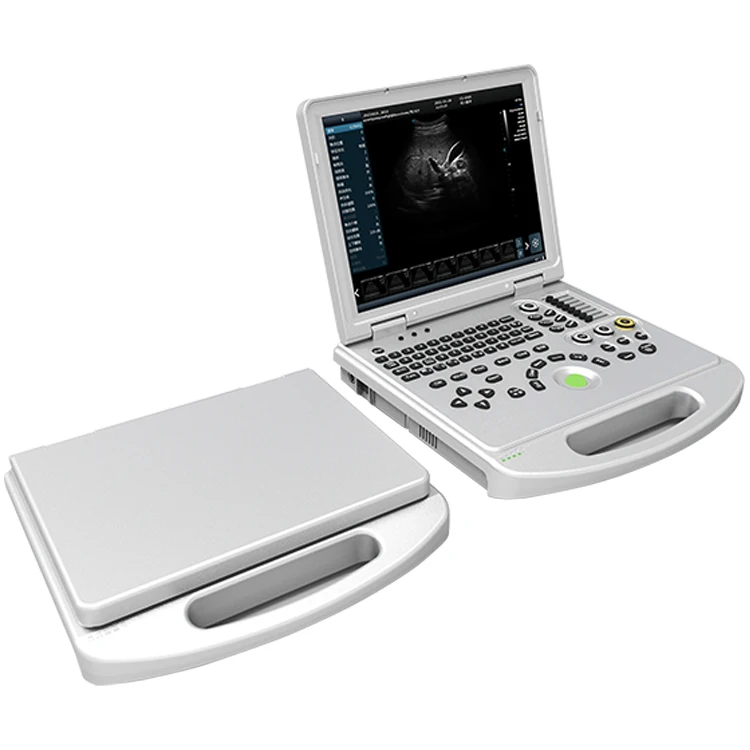 4D 5D Medical ultrasound instruments laptop for clinic hospital portable color doppler ultrasonic ecografo portatil