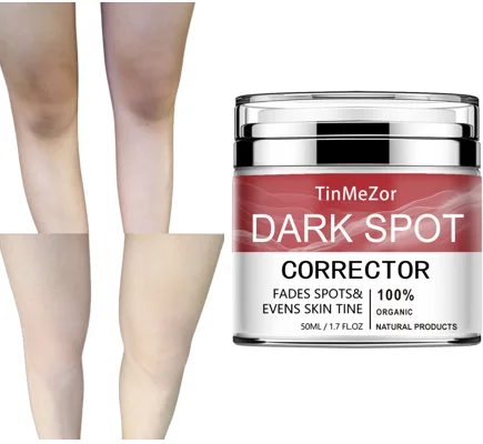 Oem Turmeric Oil White Rice Whitening Face Fairness Body Lightening Cream Body Lotion Dark Spot Remover Cream