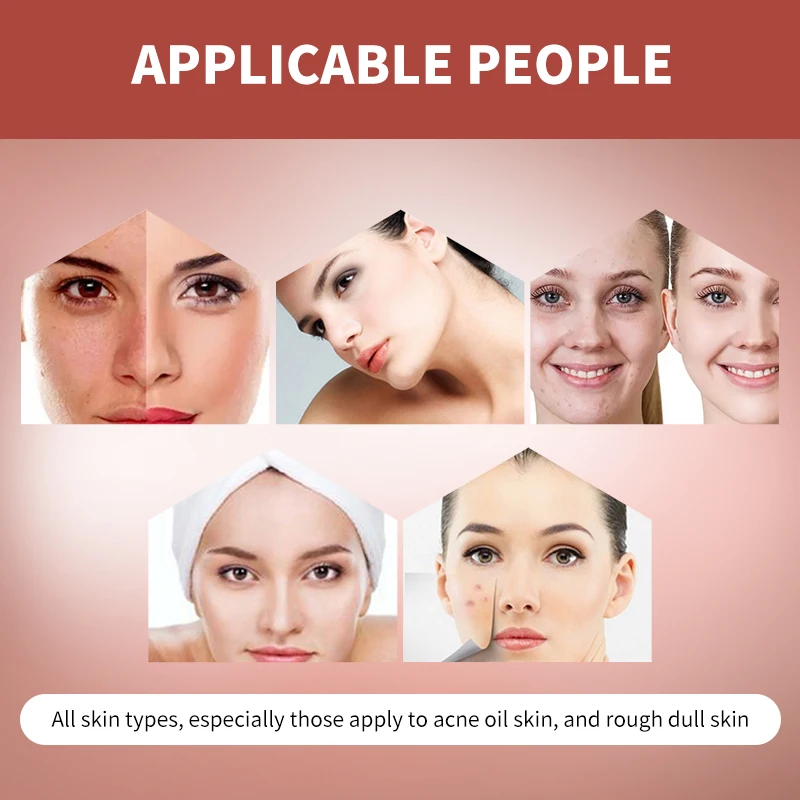 Lactic Acid 10% HA Serum Facial Moisturizing Essences Soften The Stratum Corneum Of The Skin Lmprove Dry Skin Serum