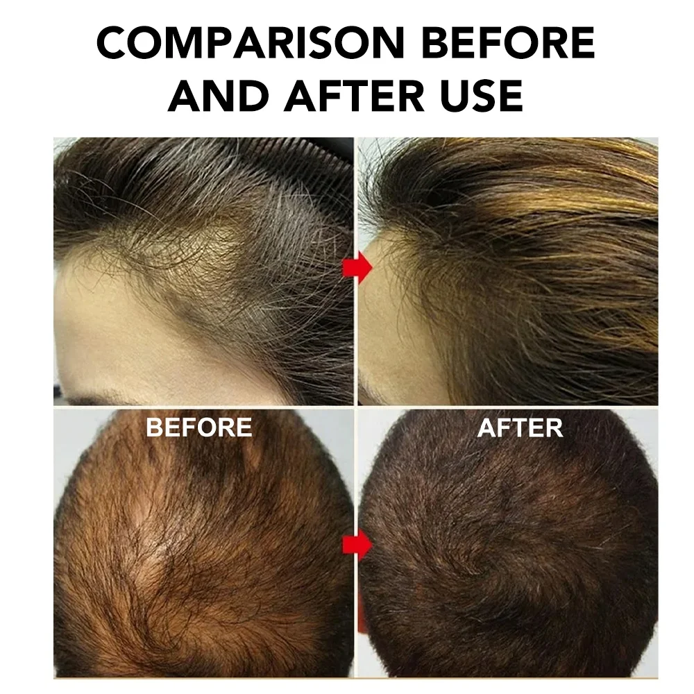 Growth For Hair Rosemary Oil Serum Repairs Luxury Hair Growth Rosemary Mint Hair Serum Oil