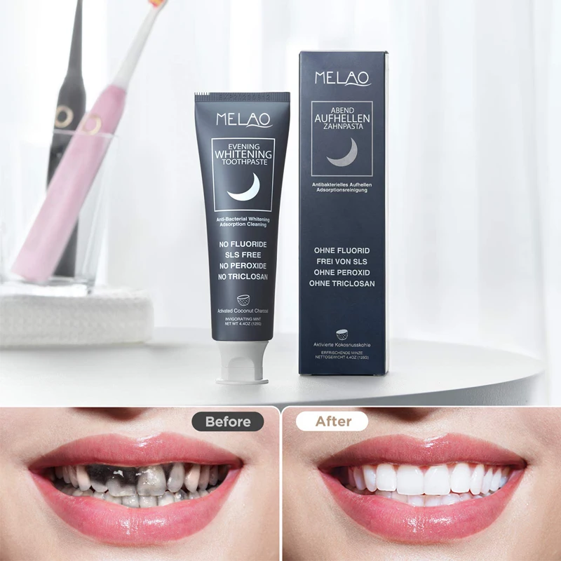 Private label New style day and night toothpaste Teeth Whitening Toothpaste Kit for tooth