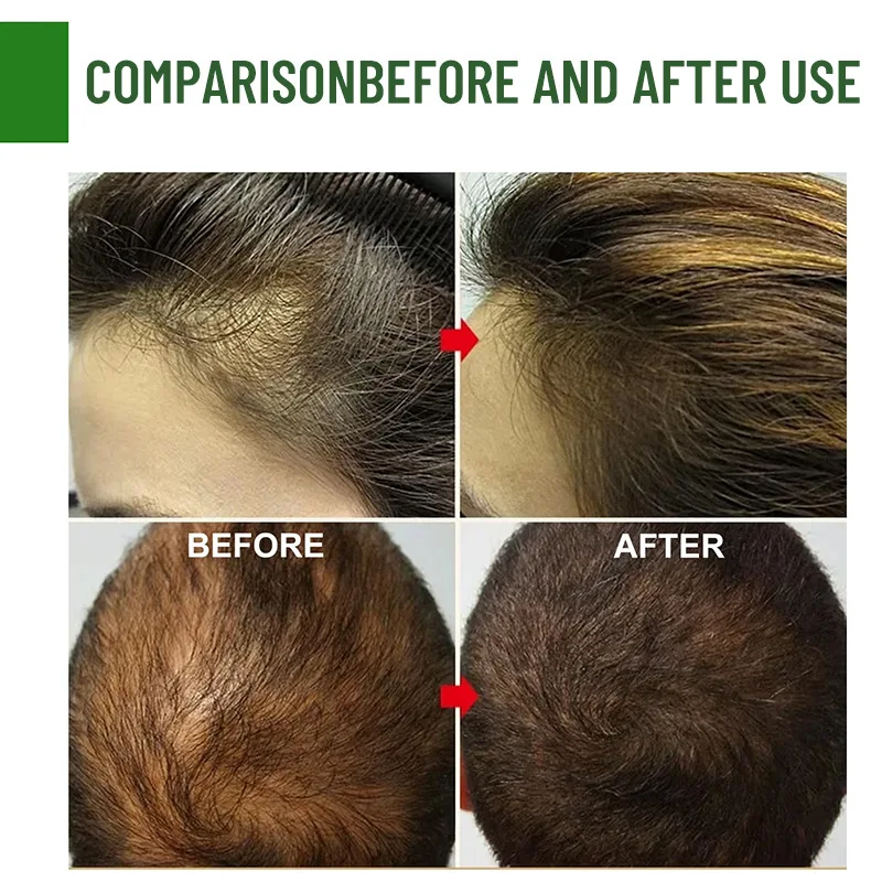 Private Label Hair Care 100% Natural Herbal Organic Wholesale Loss Treatment Rosemary Batana Oil Growth Serum for Hair