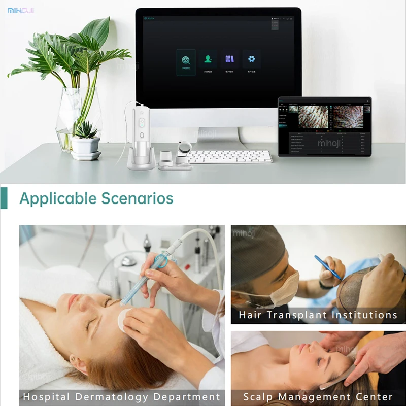 hair growth scalp and hair analysis machine professional scalp analysis