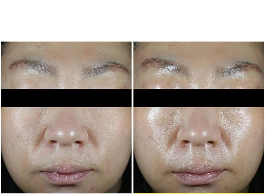 ETRUN ALISA Vegan Moisturizing Soothing Mist serum Vitamin C Anti-oxidation Anti- Wrinkle Hydrating Face Mist