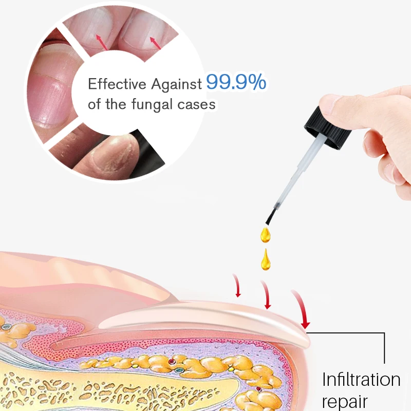 Private label natural nourishing hydrating smoothing foot care anti-fungus liquid toe nail fungus treatment