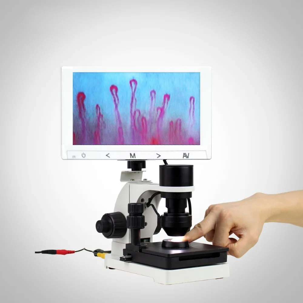 1004C  scleroderma nailfold capillaroscope capillaroscopy test equipment capillaroscopy microscope