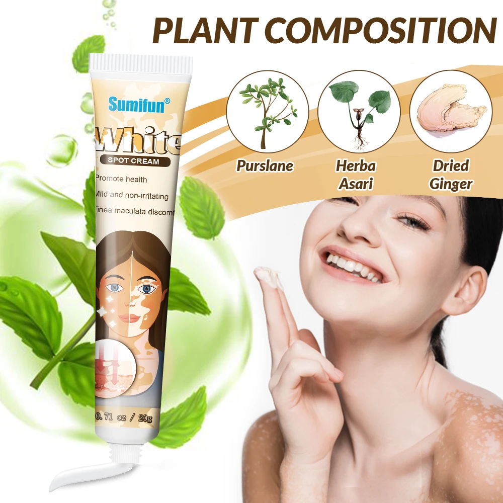 Sumifun White Vitiligo Treatment Improve Skin White Spot Relief Ointment