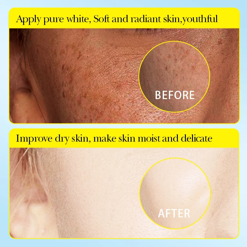 SADOER Organic Natural VC Lemon Fruit Facial Mask Sheet Form for Nose Use Moisturizing and Whitening Skin Care Beauty Product