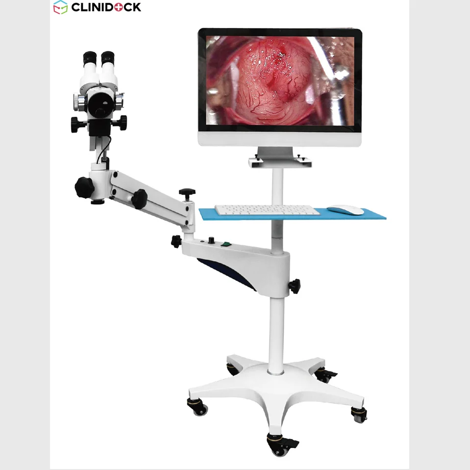 Hot Sale Camera Vagina check equipment/ high-tech computer software vagina microscope/ Medical vaginas check microscope