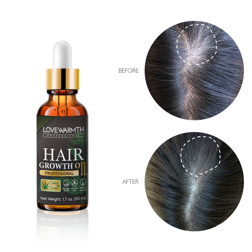 Best Regrowth Hair Oil Private Label Vegan Organic Nourishing Hair Care Product Fast Hair Growth Oil