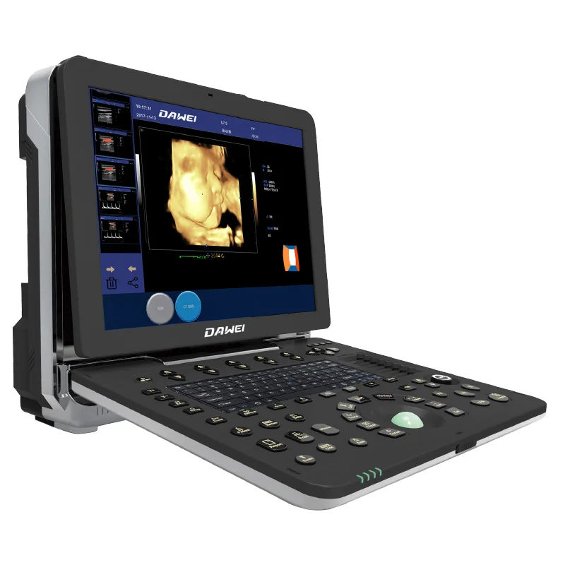 DW-P6 4D портативный УЗИ ультразвуковой