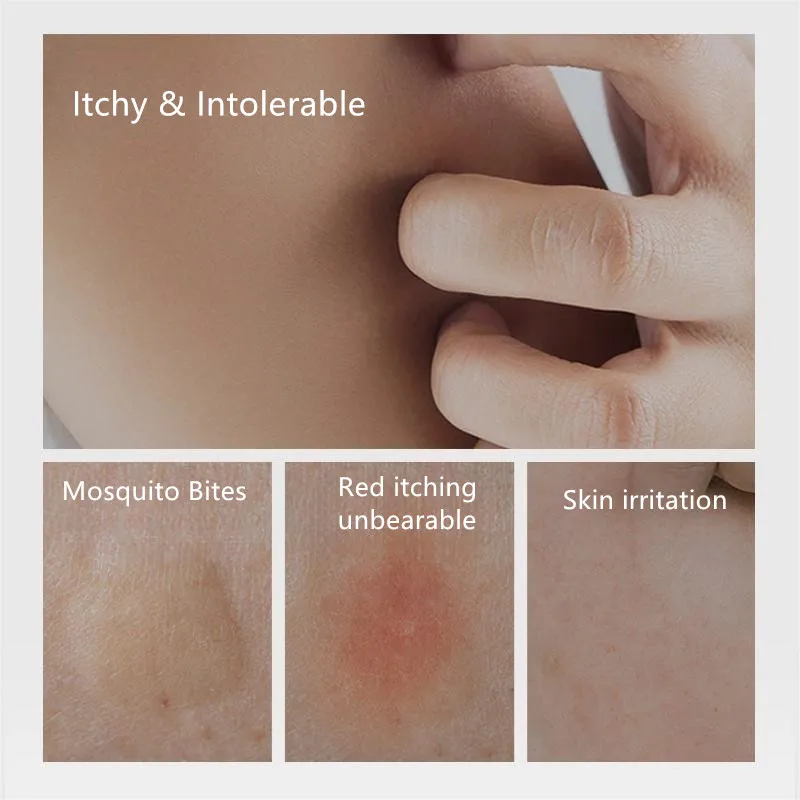 HANBOLI Lithospermum Cream Anti Bite Mosquito Repellent Stick Portable Relieve Itching Summer Mosquito Repellent Cream