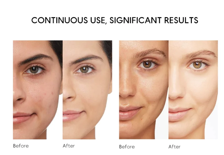 Wholesale EGF Repair Serum Face Firming Serum Face Serum Skin Care Private Label