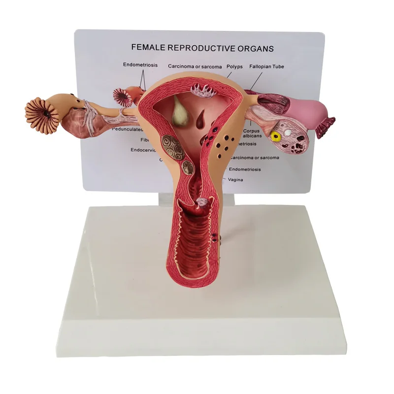 Human Anatomical Pathology Uterus Model of Medical Science Model