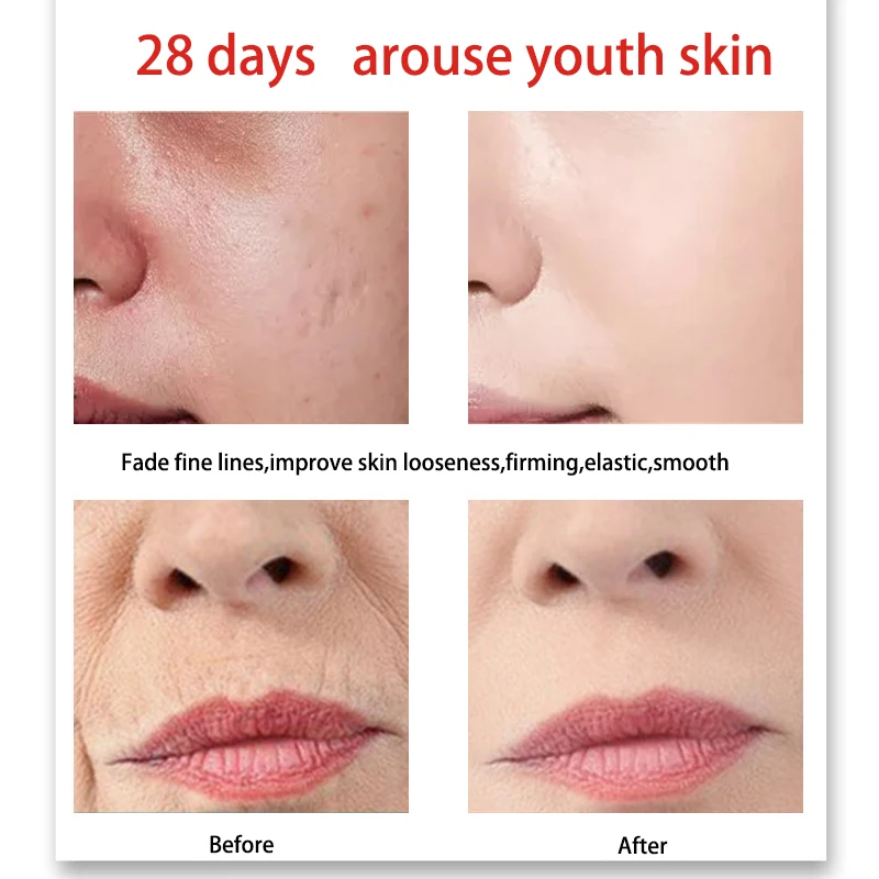 Six peptide anti wrinkle Face Cream Beauty  Anti wrinkle  Whitening cream Skin Spot   lightening cream OEM Cosmetics