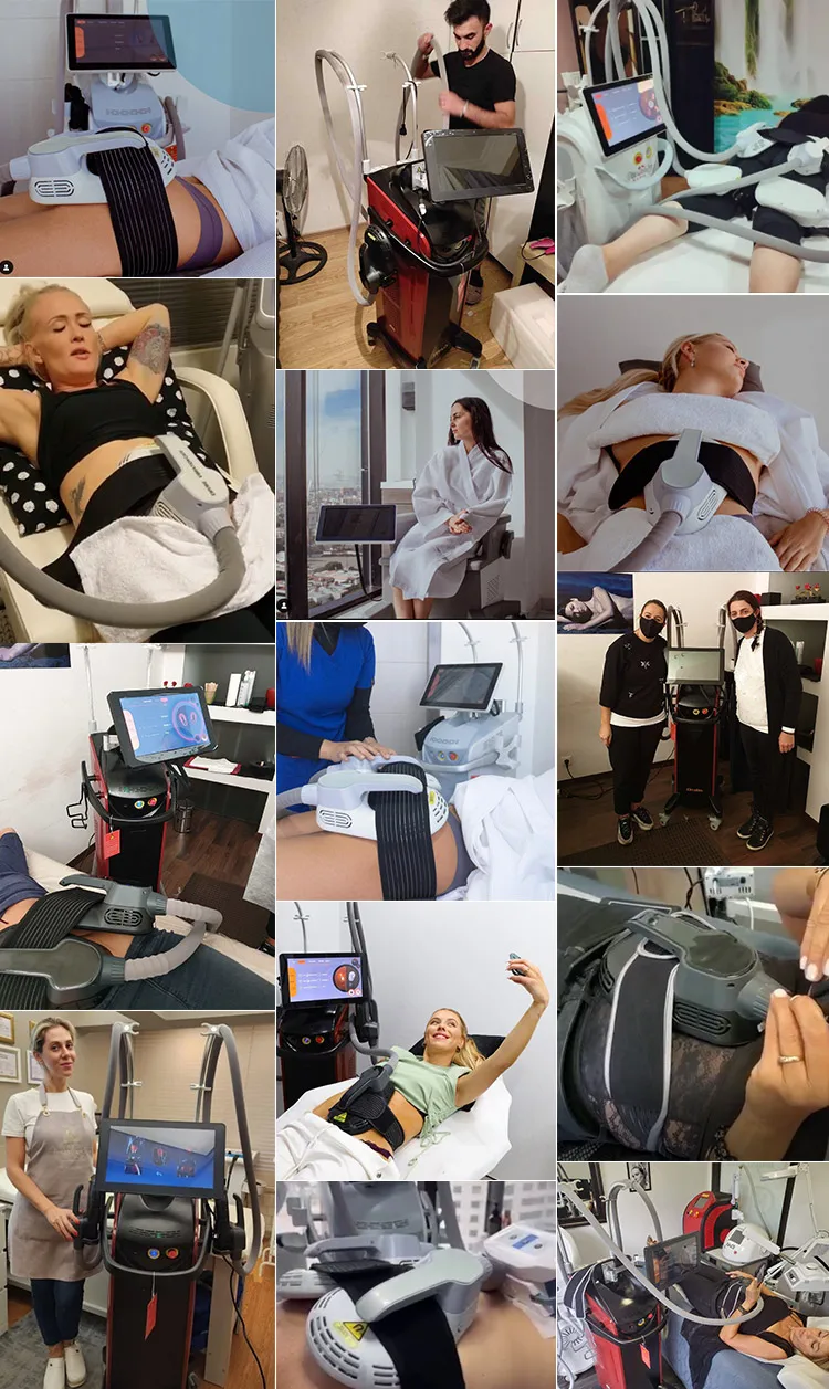 Stationary CO2 Fractional Laser Machine for Vaginal Skin Tightening and Scar Removal Laser Beauty Equipment