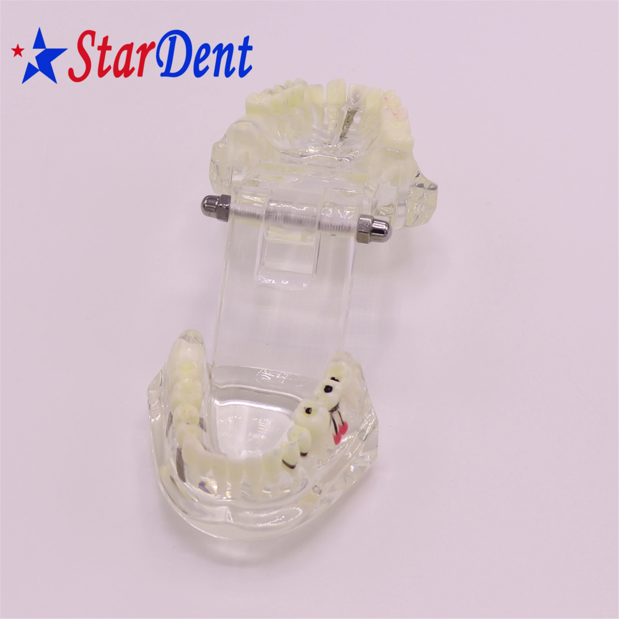 Dental  Teeth Implant Model For Tooth Implant Practicing