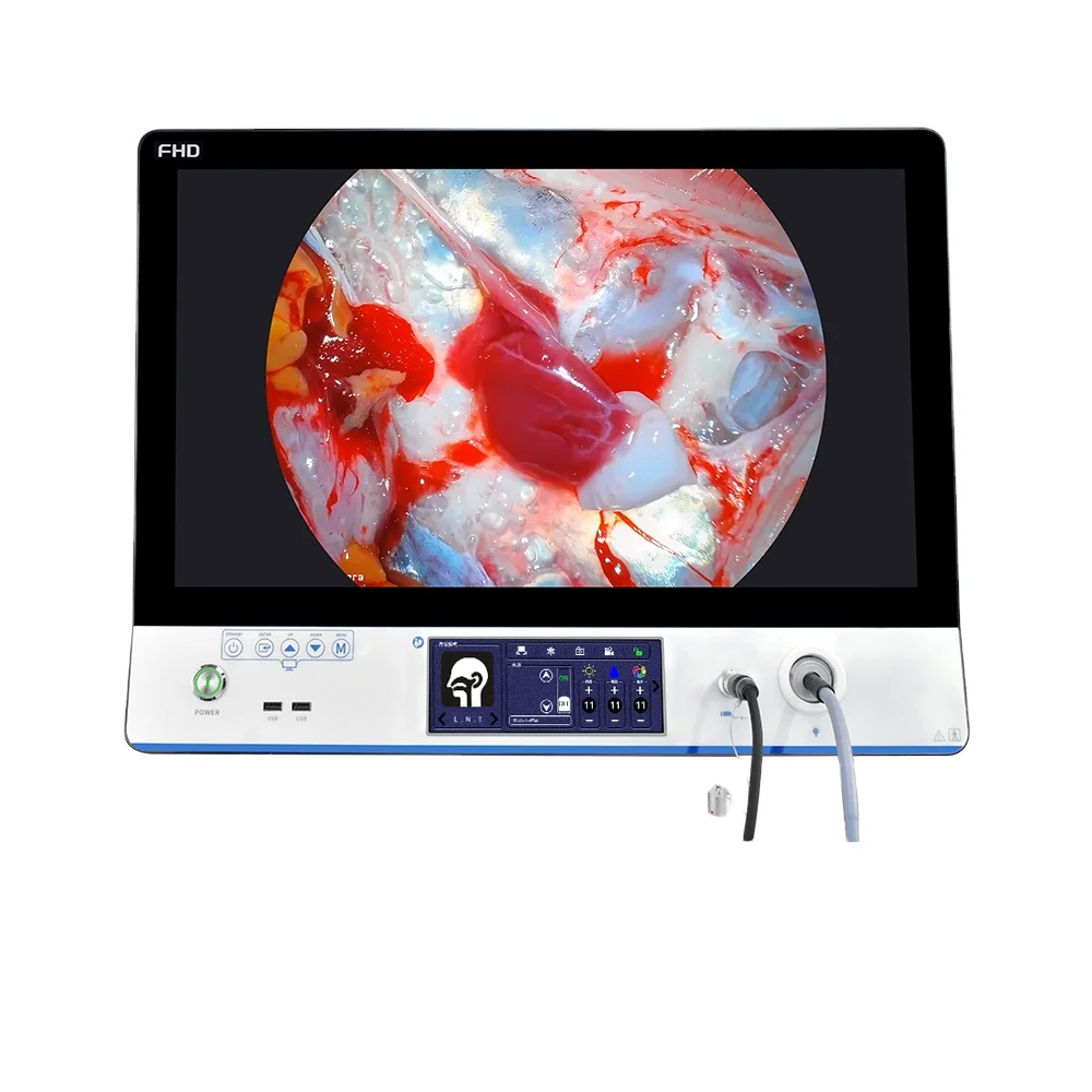 SNUKE Portable Endoscopy Camera Medical Imaging Equipment HD Endoscope Camera for ENT/Laparoscopy/Hysteroscopy