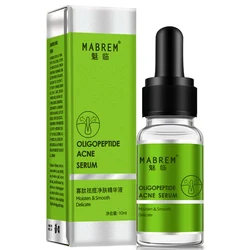 Oligopeptide acne cleaning lotion serum Vitamin A Oil Control Pore Refining Glycolic Acid Anti Acne Aha Serum