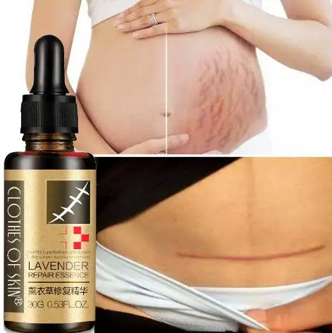 
Essential Massage oils Scar Removal Lavender Oil For Pregnant Women Hyaluronic Acid Serum Oil Essential Face Anti Acne 