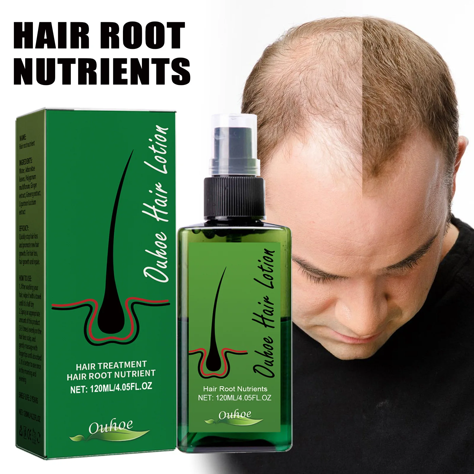 2024 Factory wholesale hair repair regeneration spray 120ml, suitable for men and women bald hair oil