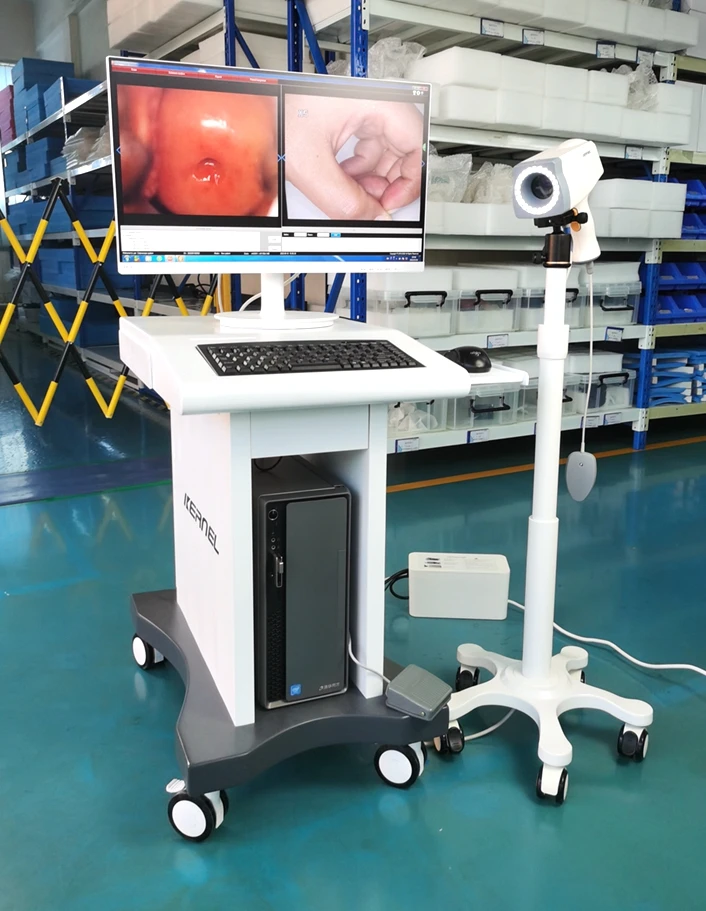 Colposcopio Kernel KN-2200 Vagina Digital Optic Portable Video Colposcope Camera Colposcop with HD CCD for Gynecology