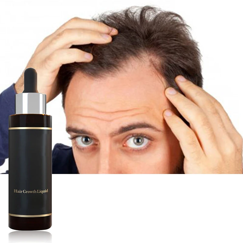 Anti Loss Itching Scalp Elixirs Herbal Instant Hair Growth Products Spray Oil For Black Women Private Label