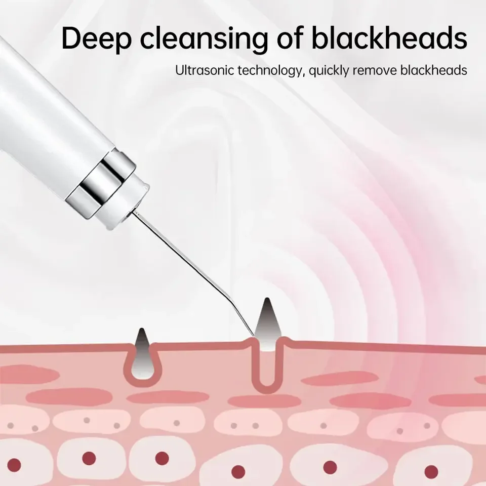 2024 Electric Facial Dead Skin Peeling Professional Blackhead Remover Facial Scraper Sonic Clean Ultrasonic Skin Scrubber