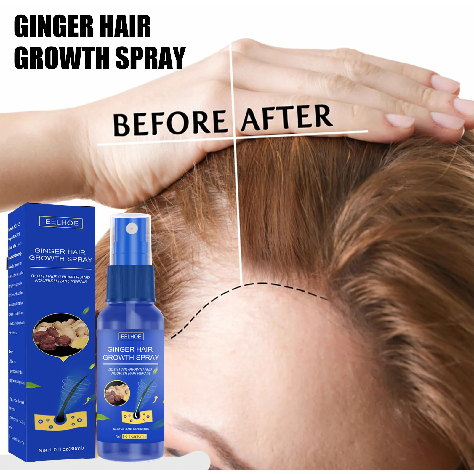 EELHOE Ginger hair growth spray Scalp Massage moisturizing thick hair hair care nutrition spray