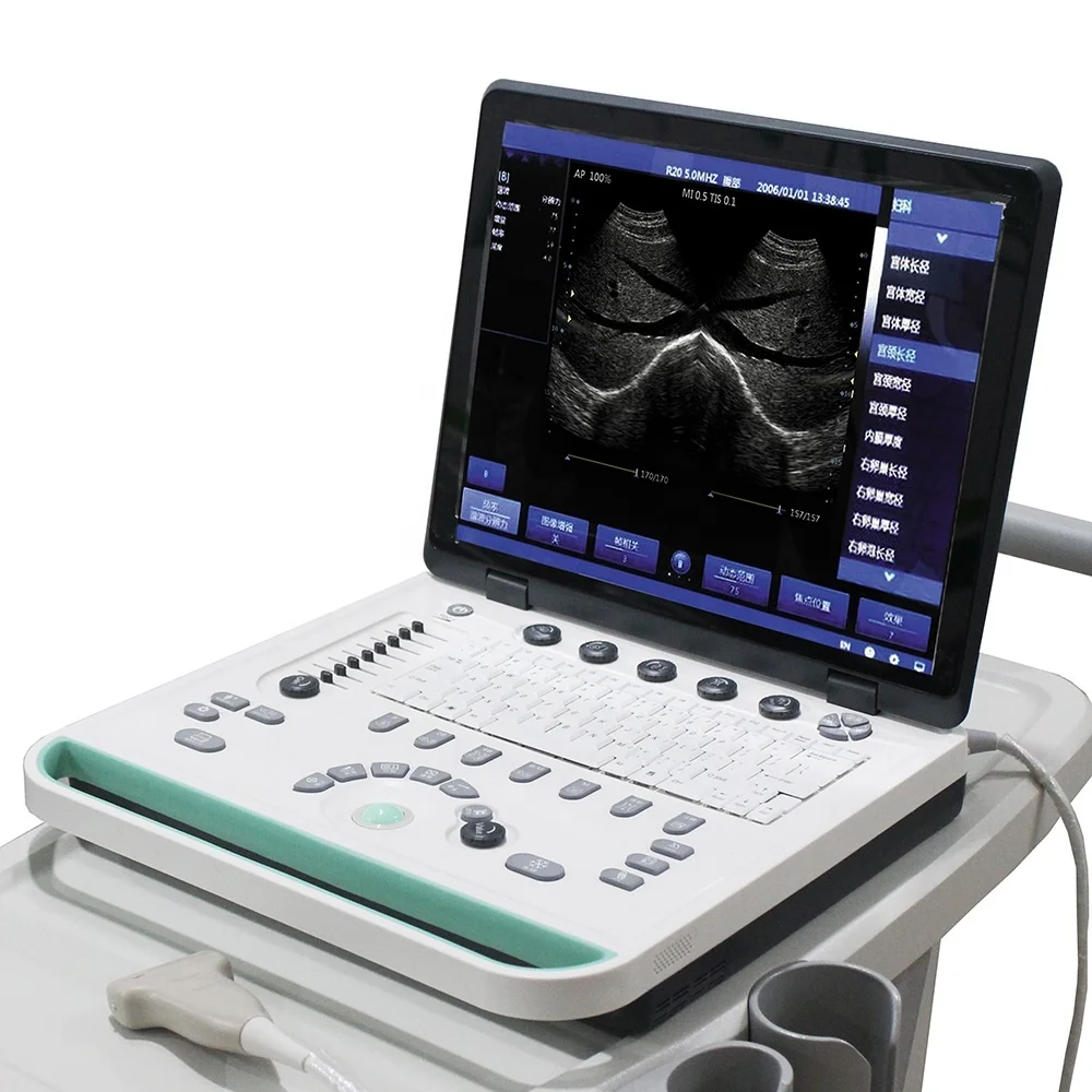 PRUS-S8000V Veterinary use Laptop Ultrasound Scanner