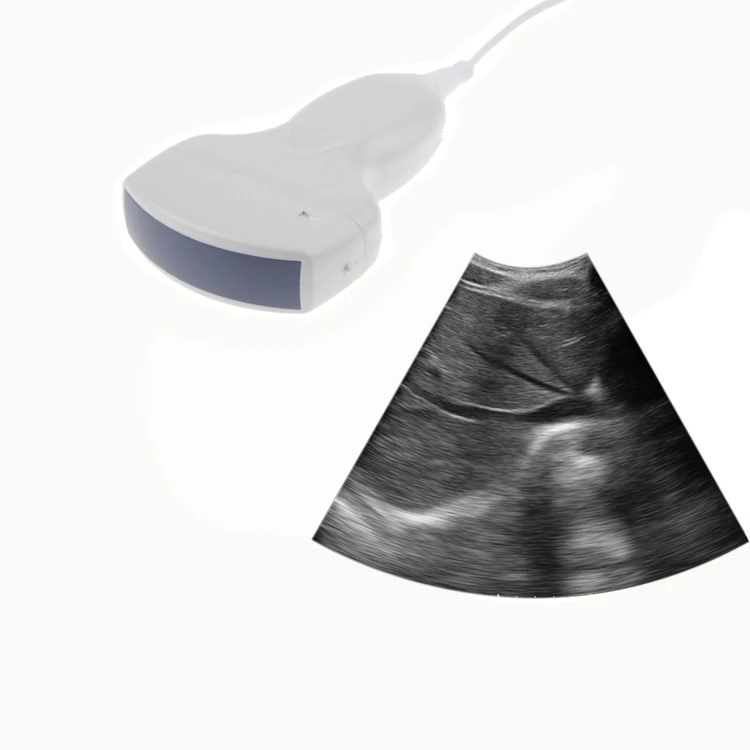 Handheld Mini Ultrasound Machine Iphone/Andriod/Ipad Use Small Size Pocket Digital Wireless Ultrasound Scanner