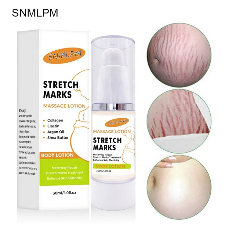 
Hot Selling Remove Scars Acne Natural Lightening Anti Stretch Mark Cream For Body 