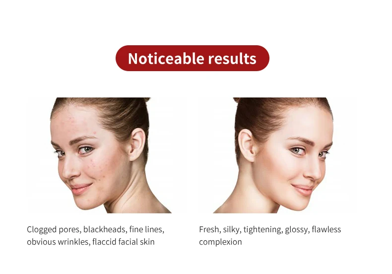 Latest Fashionable Design Portable Ultrasonic Facial Cleansing Skin Scrubber