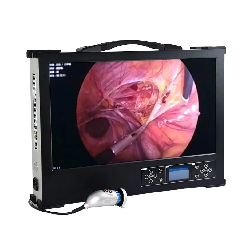 Portable ENT 24-Inch Medical Inspection Endoscope Rigid  with Electric Power Source Durable Metal and Plastic Material