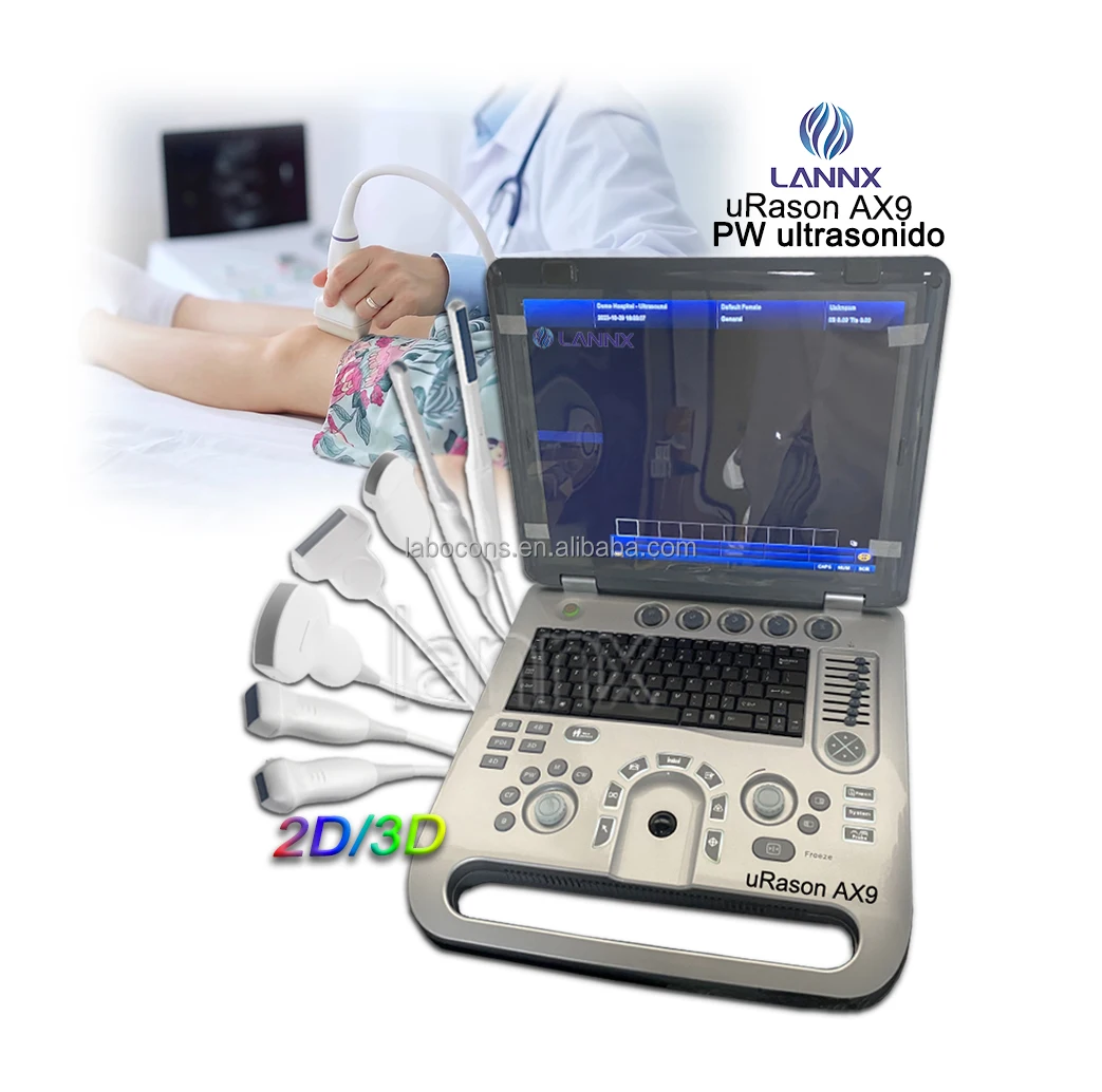 LANNX uRason AX9 Good Price Hospital Clinic Color Doppler Ultrasound diagnostic Scanner CFM PWD ultrasonography Machine