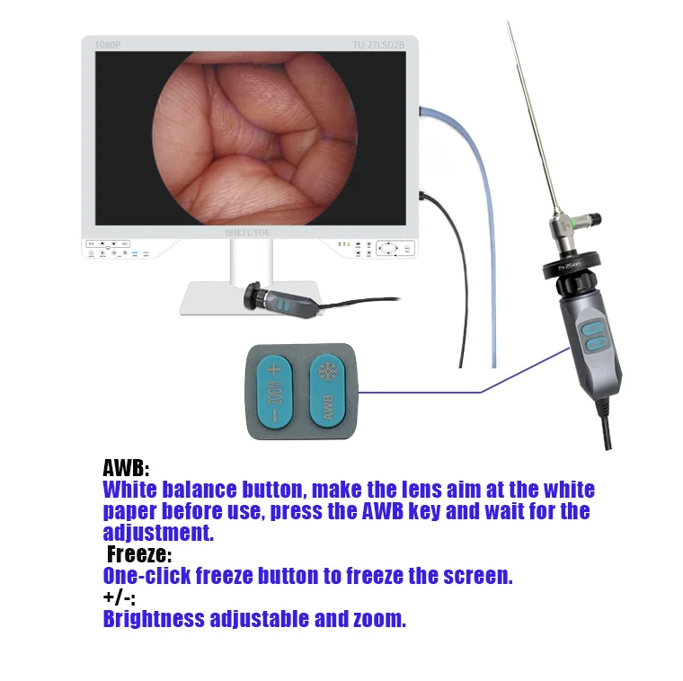 27 inch All in One Medical Endoscope Camera System with Inside LED Light Source Works for Laparoscope Uteroscope Cystoscope