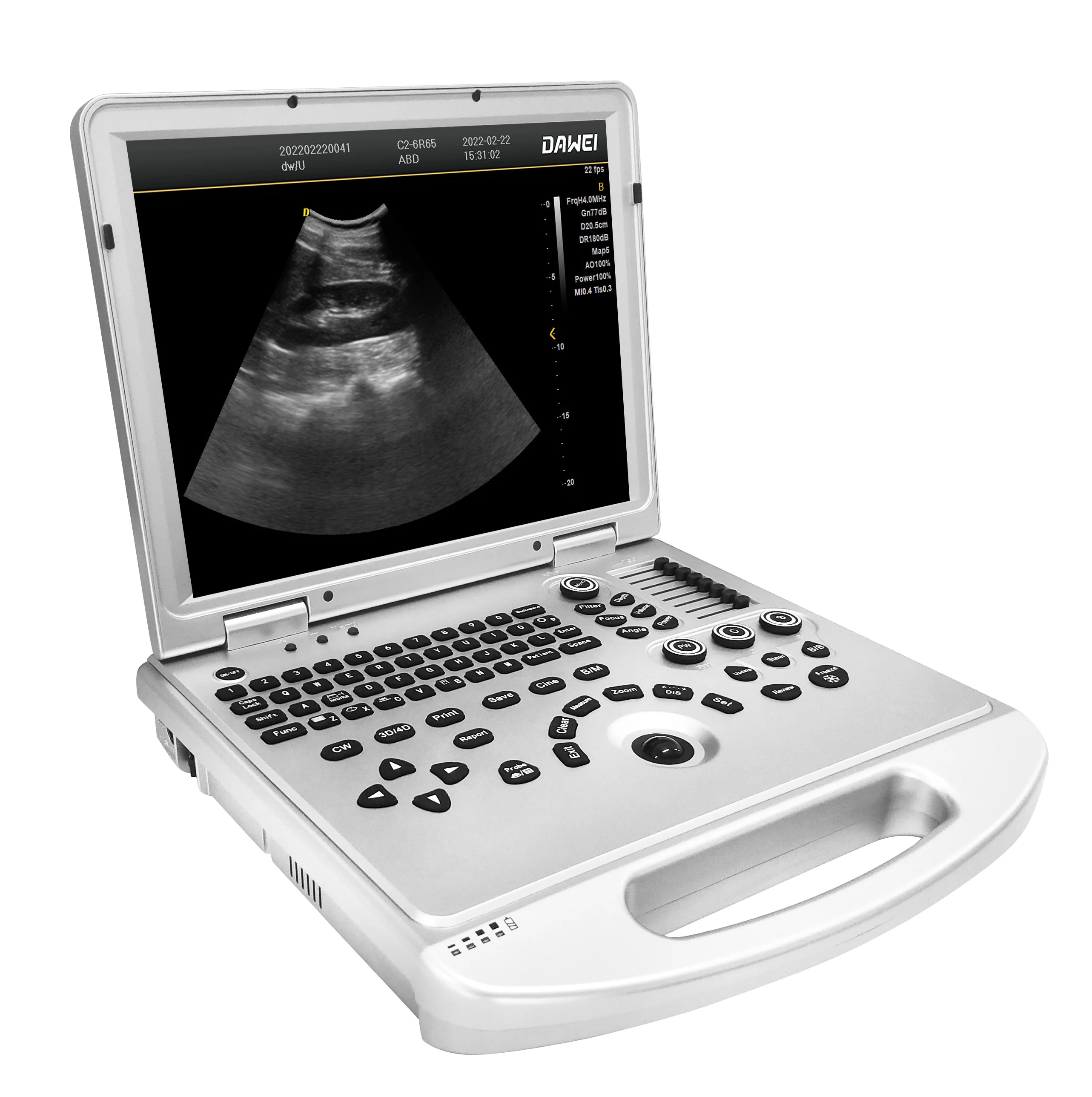 New 2D portable Color Doppler Human Gynecology echo ultrasound machine