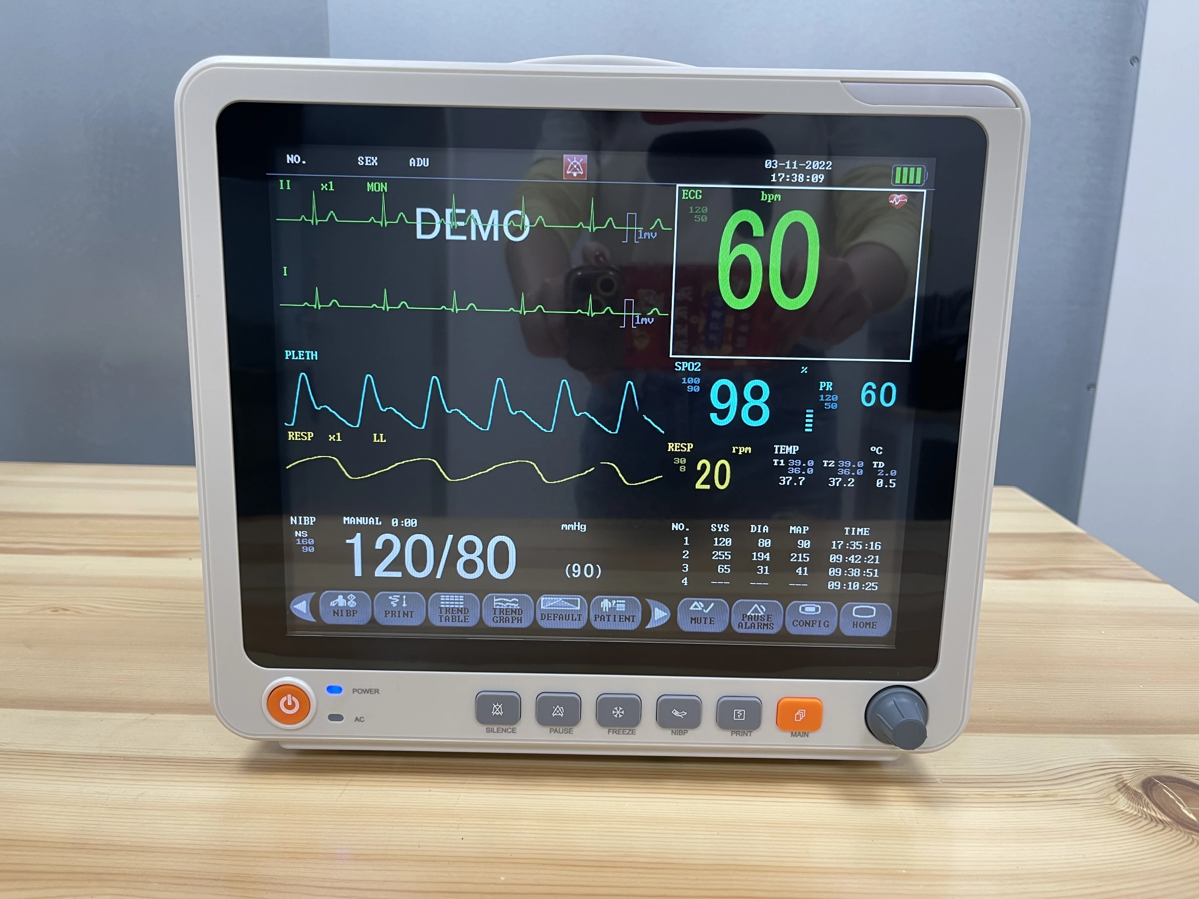 High Quality Hospital Use 12 Inch Touch Screen Multi Parameter Vital Signs Vet Monitor For Vet Patience
