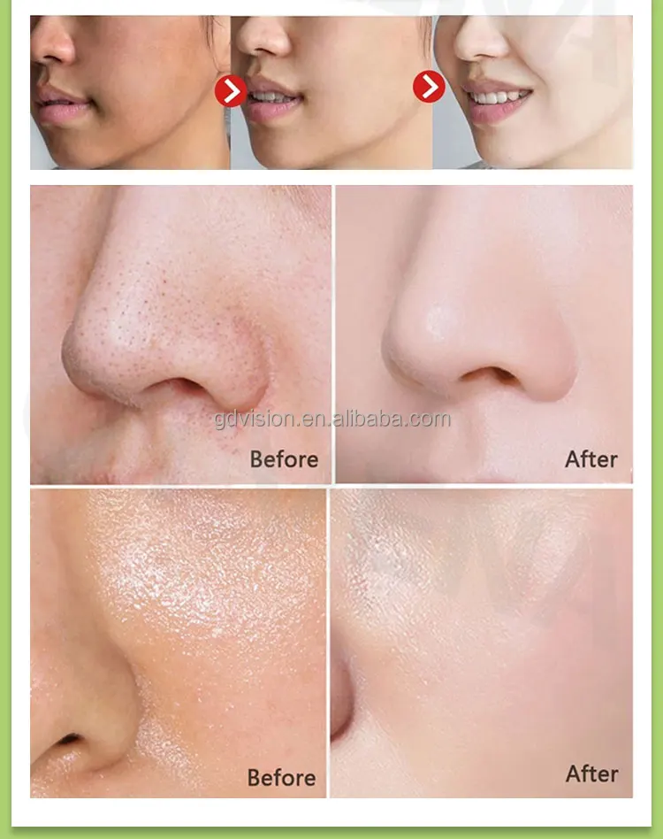 Private Label Skin Lightening Acne Removing Natural Handmade Goat Milk Soap