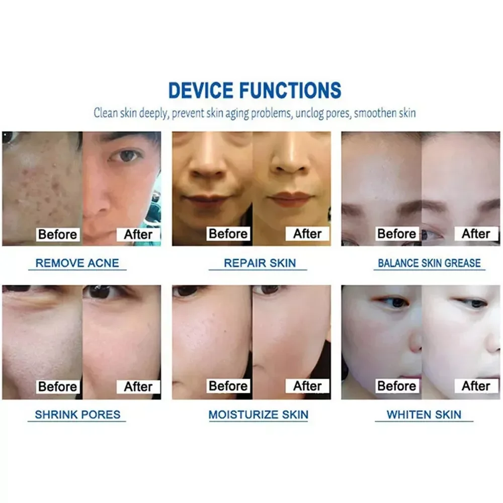 Professional Vacuum Cleaning Hydra Jet Oxygen Facial Machine for Home and Beauty Salon