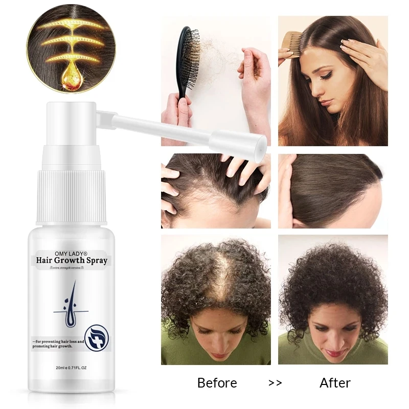OMY LADY Hair Growth Spray Improve Prevent Hair Loss Products For Men Women