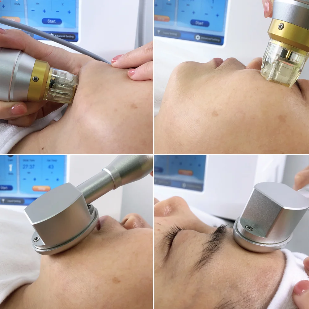 Fractional RF Microneedle Skin Tightening Device Professional Thermagic RF Machine (F019)