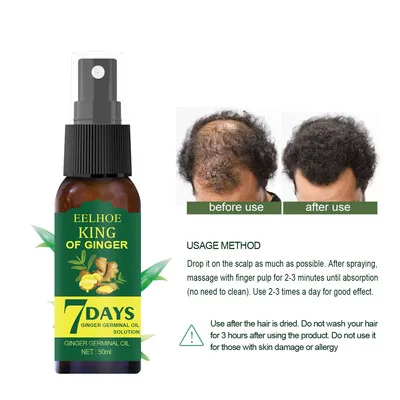 OEM 30ml/50ml EELHOE KING of Ginger Hair Growth Nutrition Liquid Hair Loss Control Hair Spray