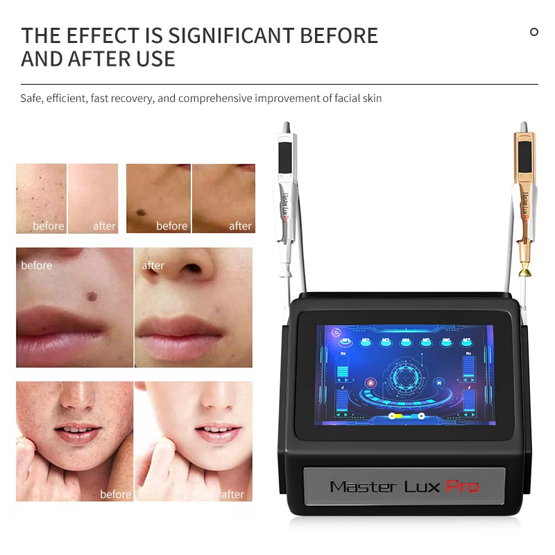 New Technology Ozone Plasma 2 In 1 Anti-Aging Improve Fine Lines Remove Scar Beauty Device Facial Blemish Removal Machine